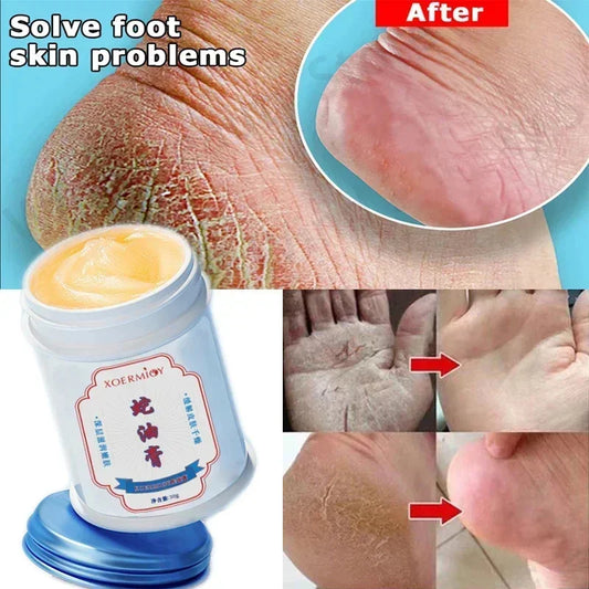 Herbal Anti Heel Cracked Cream Repair Crack Drying Hand Foot Remove