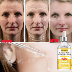 Instant Wrinkle Remover Face Serum Anti-Aging Lifting Firming Fade