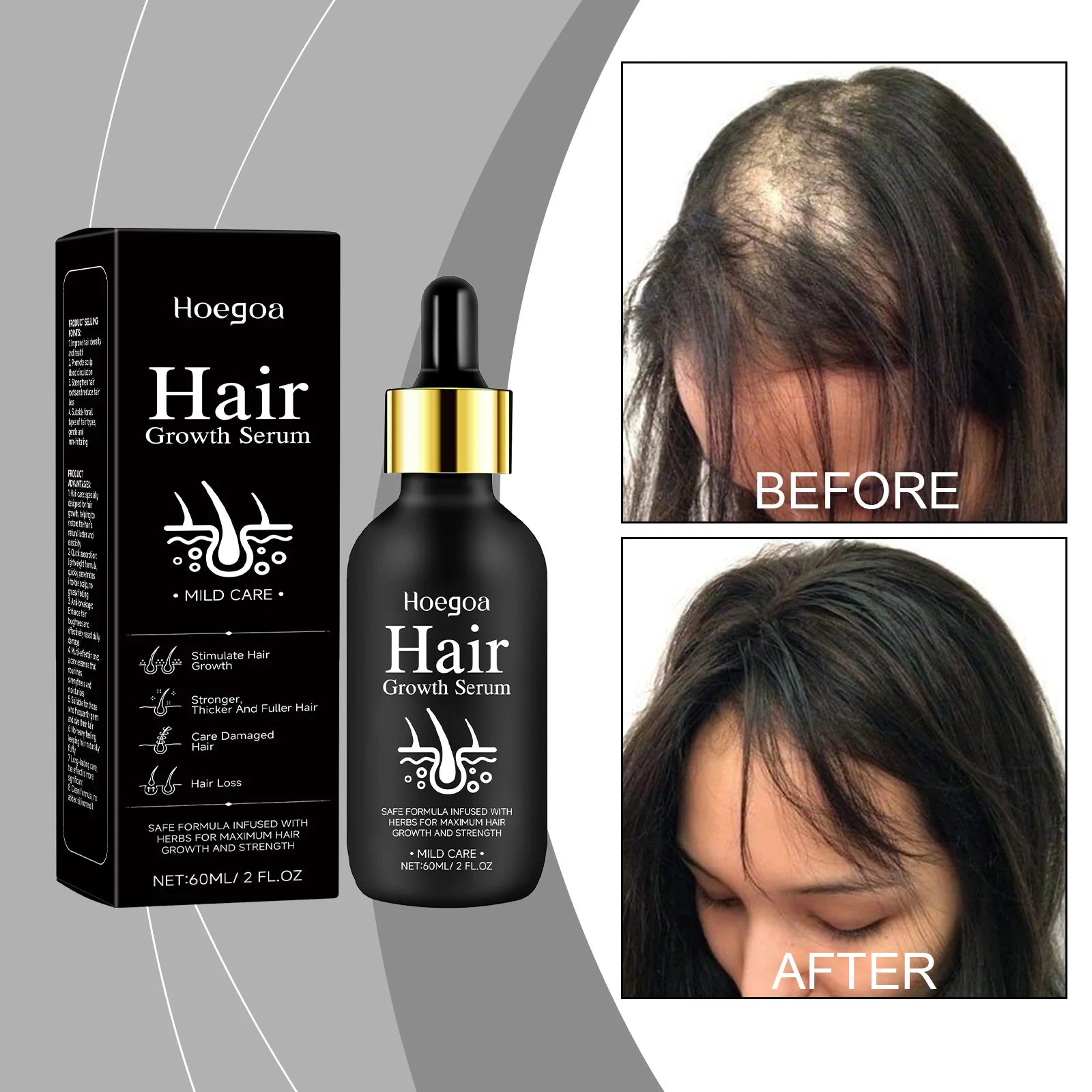 60ml For Men And Women Hair Growth Oil Hair Growth