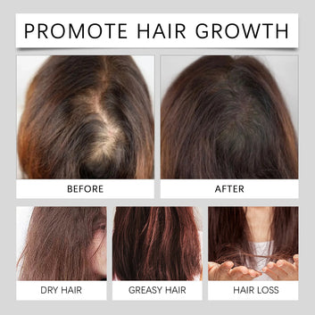 60ml For Men And Women Hair Growth Oil Hair Growth