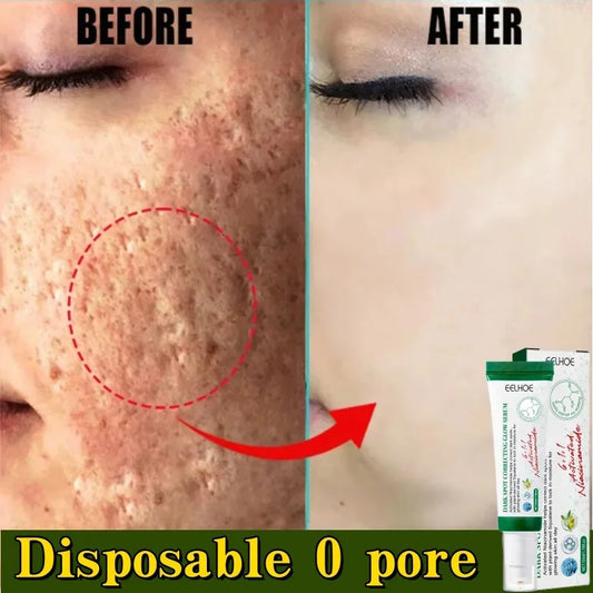 Pore Shrinking Cream Acne Pit Repair Product